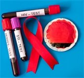 HIV test tubes and supplies