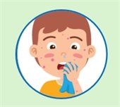 Cartoon image of child with measles