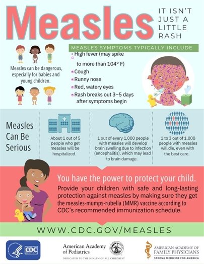 Measles Infographic from the CDC